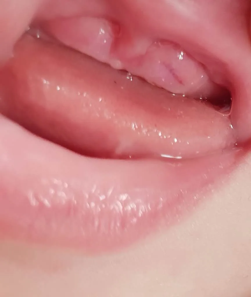 xjjspkss10f0.webp