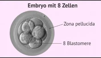 ftatok34eyde.webp