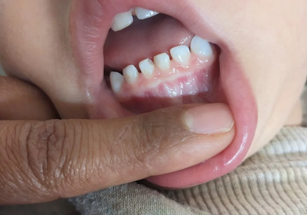 bufs95ueqqt2.webp