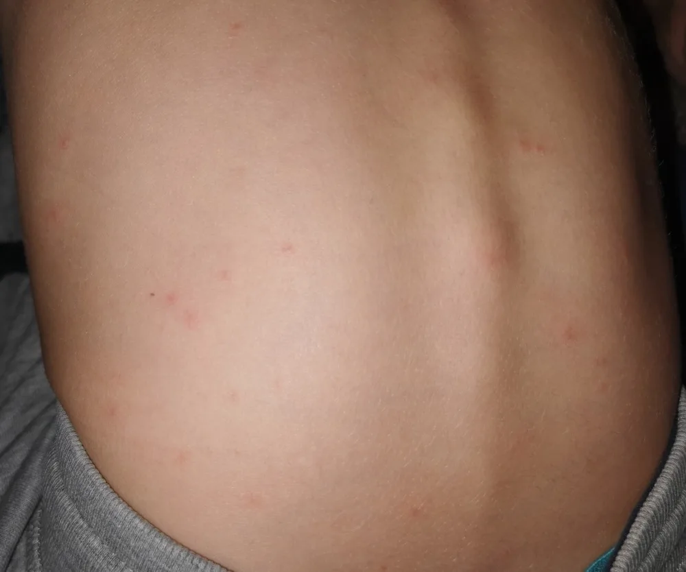 3lubhs2agm2g.webp