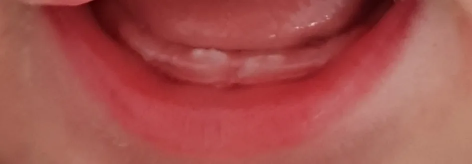 cr2bicnzwca1.webp