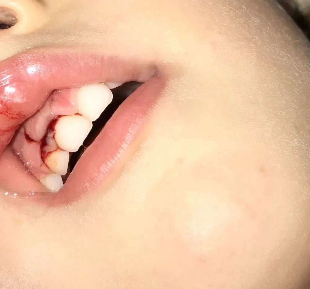 gsexmecxavqx.webp