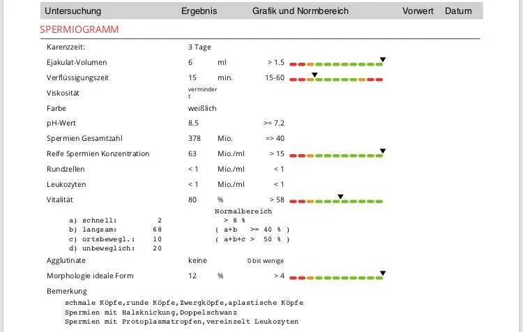 ocbqvgqfaz06.webp
