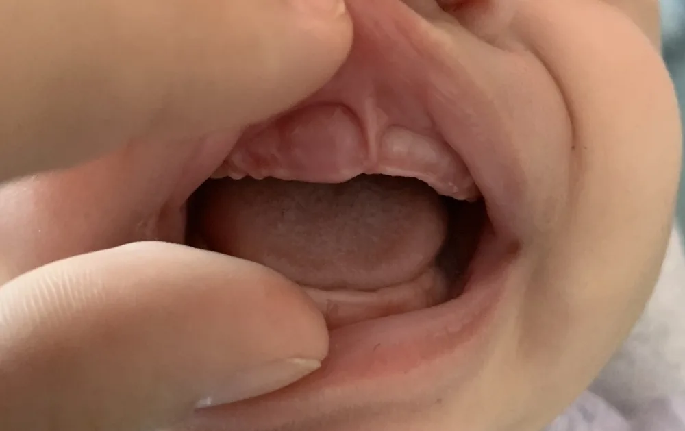 vgdr05ylt6cv.webp