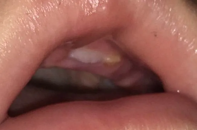 lyo3sgf8it2f.webp