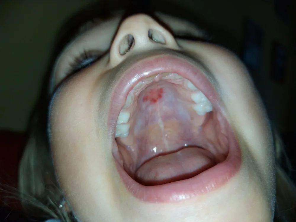 0n1ercnjyg93.webp