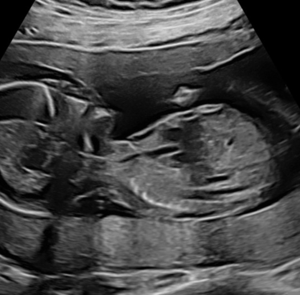 lq67yf61vjc1.jpg