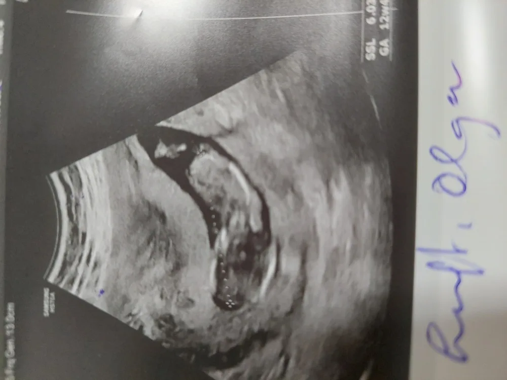fvgpltq5vf92.webp