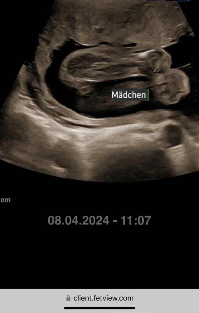 me37mx5o8527.webp
