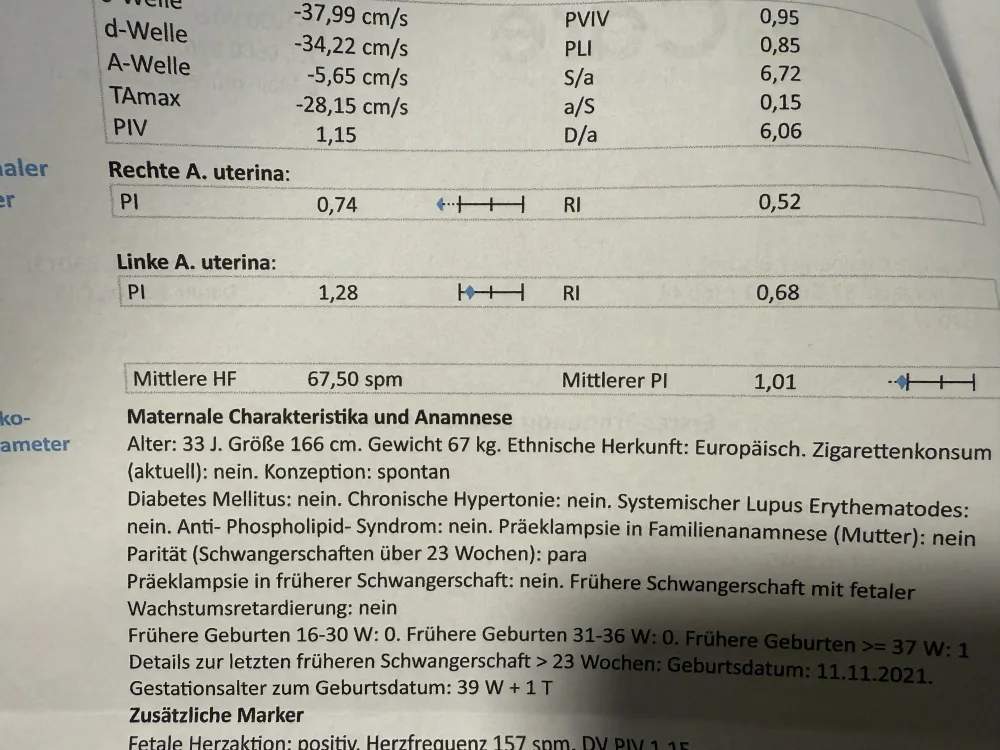d5dhoxog04a0.webp