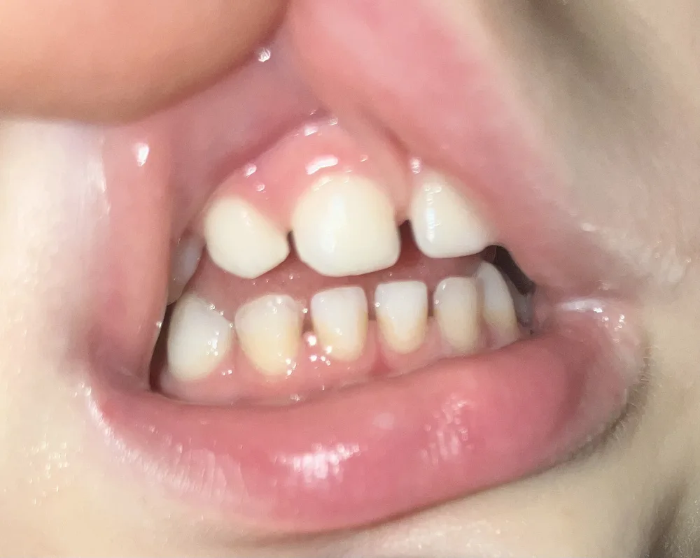 j87dgsyvh7iw.webp