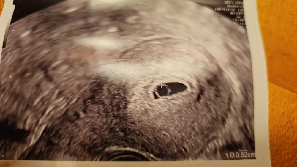 zwct7nkdvwdq.webp