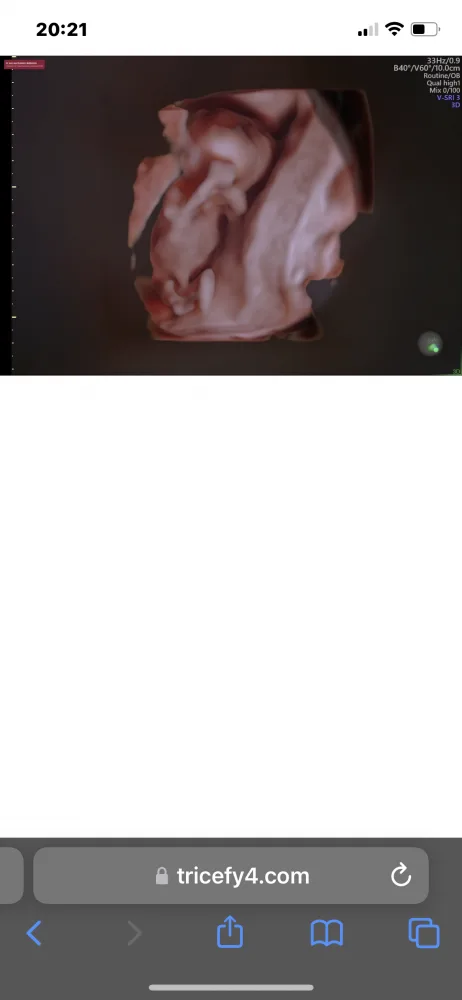 6bkf1ozrpi2t.webp
