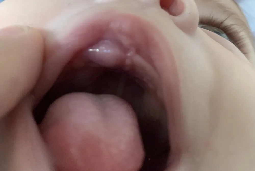 2qhcr1q7nxud.webp