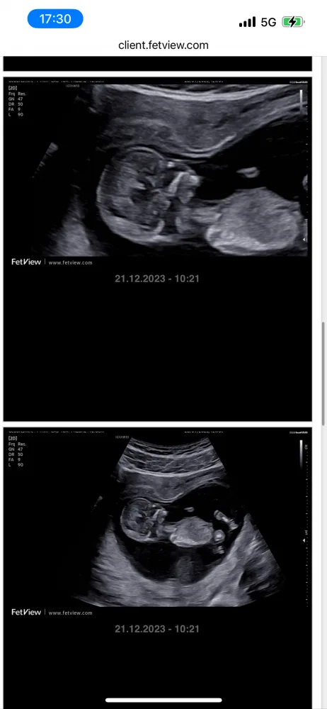 7j6bheypepmu.webp