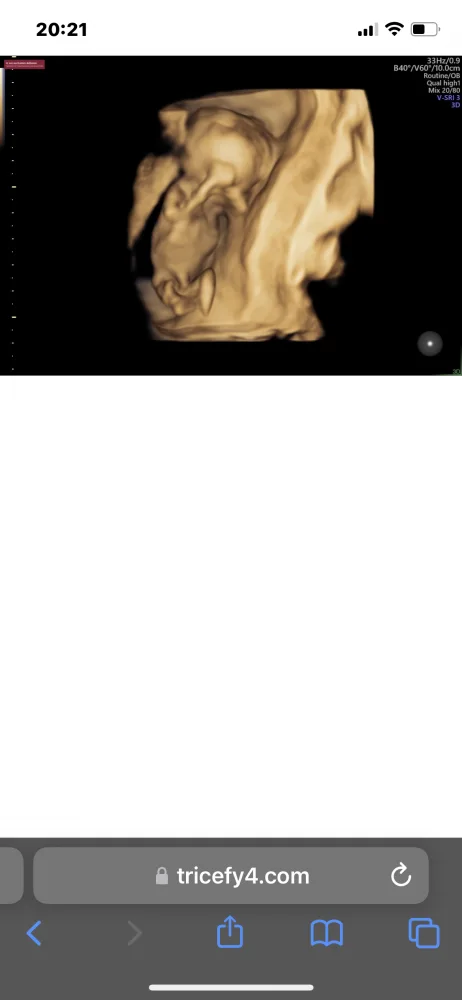 zjwnmhuc7pv1.webp