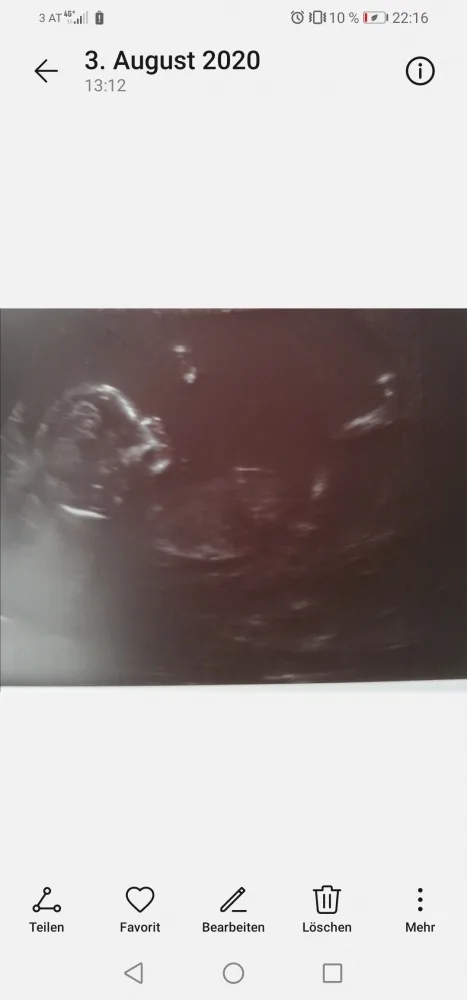 y75s7bjh2w8t.webp