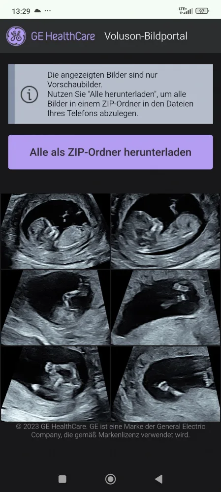 9wxehpfzd9ta.webp