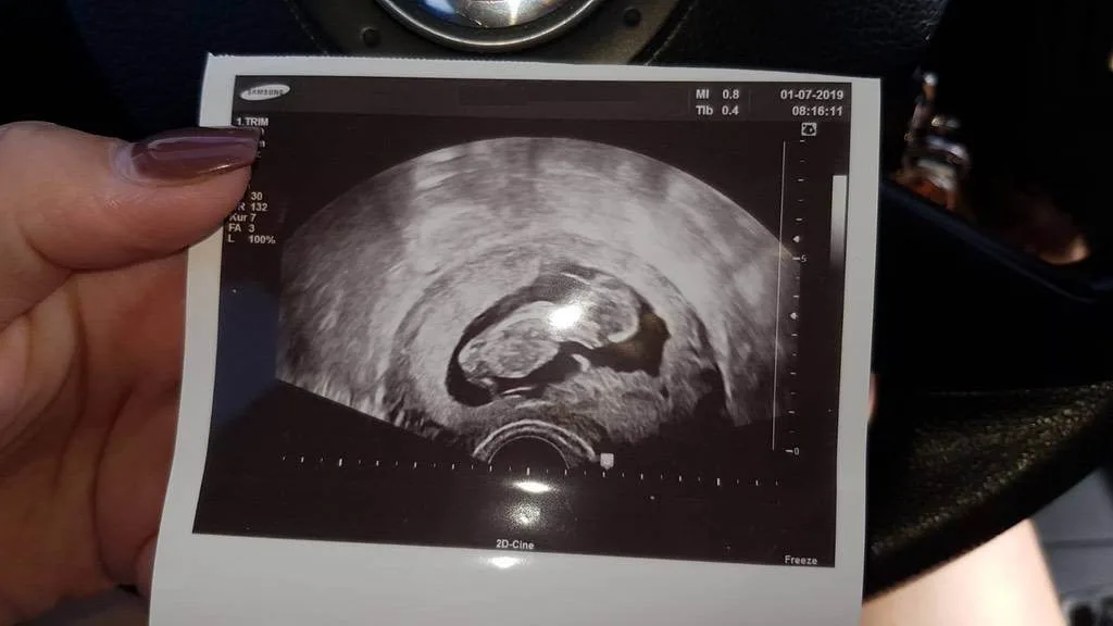 l006j8a81d9e.webp