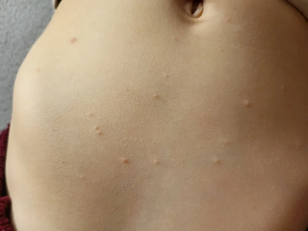 8xefnqngohpv.webp